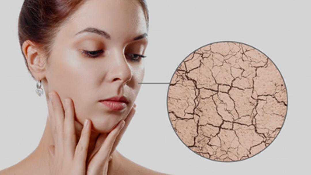 Skin tends to get flaky and exfoliates in winters. Read ahead to know the ways to tackle skin problems in the winter season.